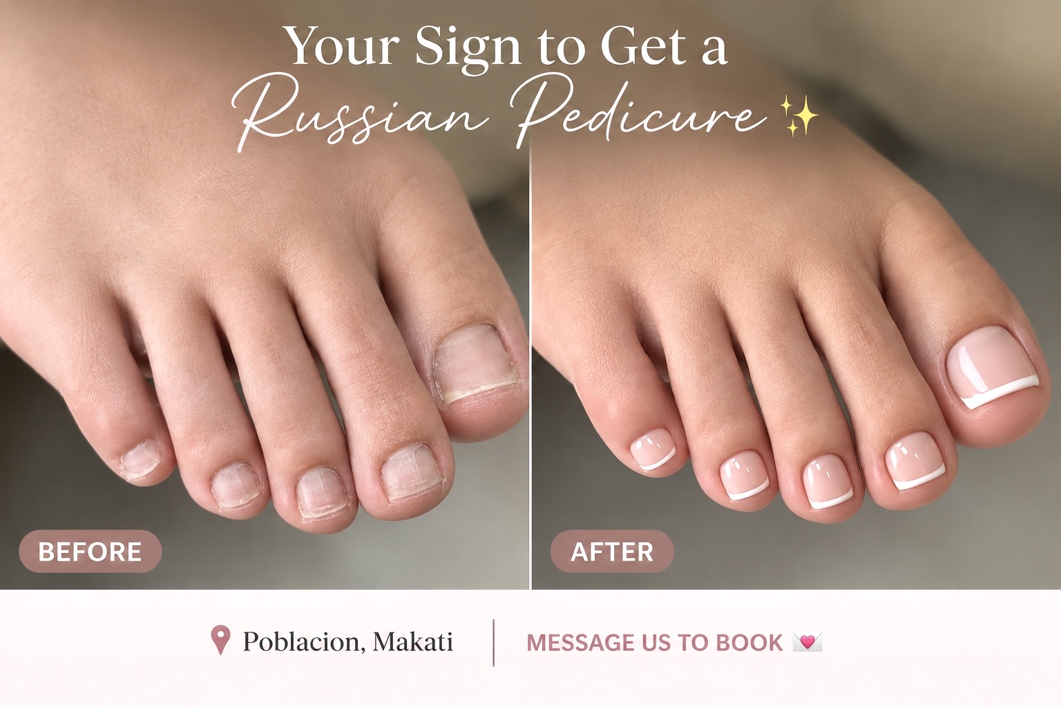 Before and after comparison of a Russian pedicure at AyuriNails Beauty Lounge: rough, uneven cuticles before, a clean French-tip finish with a smooth cuticle line after